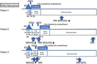 Arterial spin labeling image findings in the acute phase in paediatric patients with acute encephalopathy with biphasic seizures and late reduced diffusion